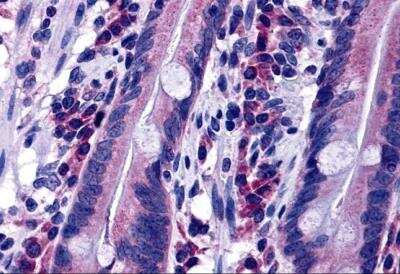 Immunohistochemistry: DISP2 Antibody - BSA Free [NBP2-81918]