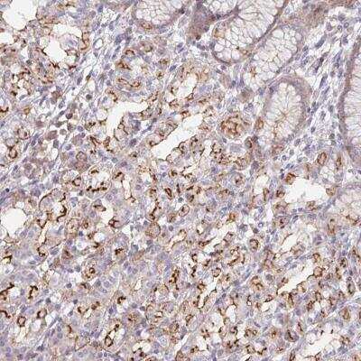Immunohistochemistry-Paraffin: DISP2 Antibody [NBP2-32498]