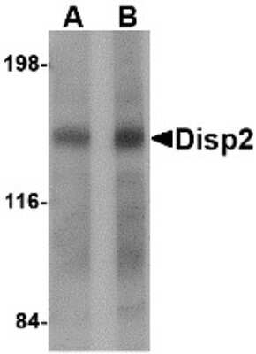 Western Blot: DISP2 AntibodyBSA Free [NBP2-81917]