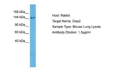 Western Blot: DISP2 Antibody [NBP2-84793]