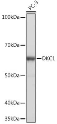 Western Blot: DKC1 Antibody (2W2V6) [NBP3-16405]