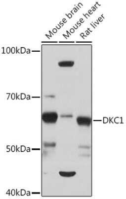 Western Blot: DKC1 Antibody (2W2V6) [NBP3-16405]