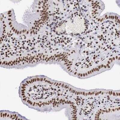 Immunohistochemistry-Paraffin: DKC1 Antibody [NBP1-85155]