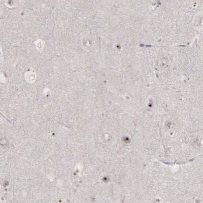 Immunohistochemistry-Paraffin: DKC1 Antibody [NBP1-85156]