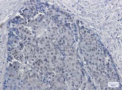 Immunohistochemistry-Paraffin: DKC1 Antibody (S02-2D8) [NBP3-14925]