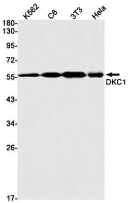 Western Blot: DKC1 Antibody (S02-2D8) [NBP3-14925]