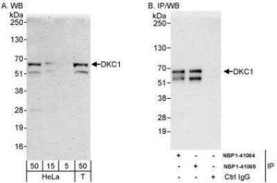 Western Blot: DKC1 Antibody [NBP1-41064]