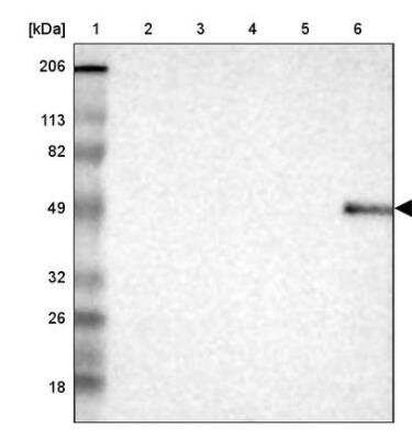 Western Blot: DKC1 Antibody [NBP1-85156]