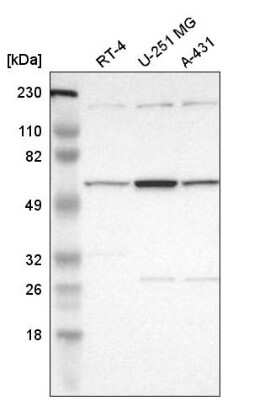 Western Blot: DKC1 Antibody [NBP2-55221]