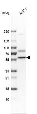 Western Blot: DKC1 Antibody [NBP2-55221]