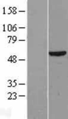 Western Blot: DKC1 Overexpression Lysate [NBL1-09897]