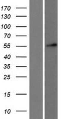 Western Blot: DKC1 Overexpression Lysate [NBP2-09647]