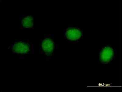 Immunocytochemistry/ Immunofluorescence: DKFZP434B168 Antibody [H00025896-B01P]