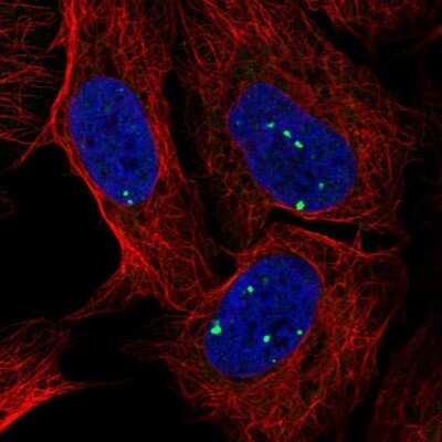 Immunocytochemistry/ Immunofluorescence: DKFZP434B168 Antibody [NBP2-68938]