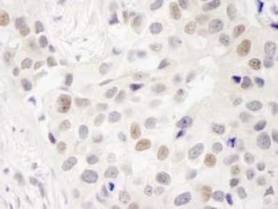 Immunohistochemistry-Paraffin: DKFZP434B168 Antibody [NB100-465]