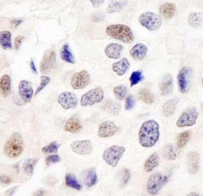 Immunohistochemistry-Paraffin: DKFZP434B168 Antibody [NB100-465]