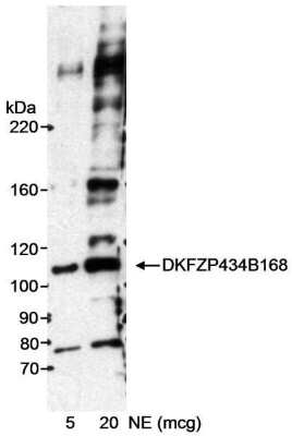 Western Blot: DKFZP434B168 Antibody [NB100-465]