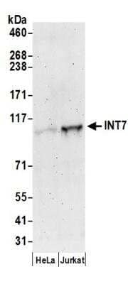 Western Blot: DKFZP434B168 Antibody [NB100-465]