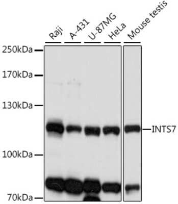 Western Blot: DKFZP434B168 AntibodyAzide and BSA Free [NBP2-92294]