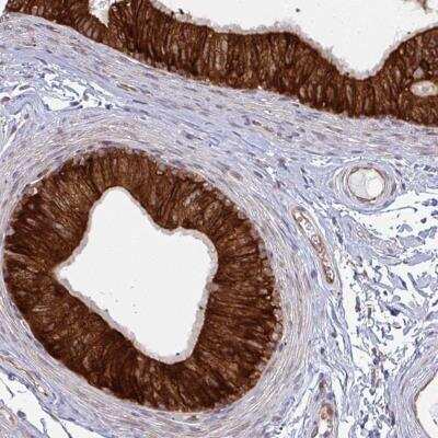 Immunohistochemistry-Paraffin: LYSMD4 Antibody [NBP2-49305]