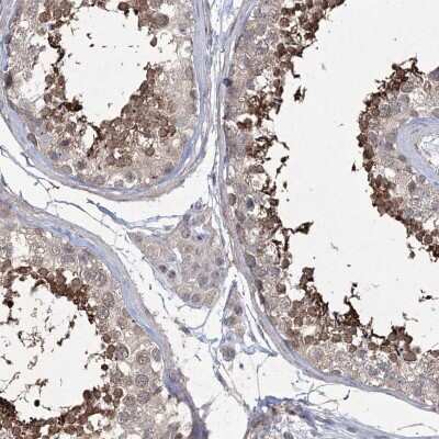 Immunohistochemistry-Paraffin: DKFZp566F084 Antibody [NBP1-87988]