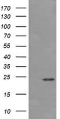 Western Blot: DKFZp566F084 Antibody (OTI4B9)Azide and BSA Free [NBP2-71779]