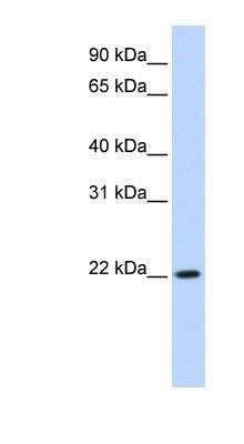 Western Blot: DKFZp566F084 Antibody [NBP1-55201]