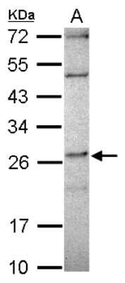 Western Blot: DKFZp566F084 Antibody [NBP2-16171]