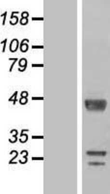 Western Blot: DKFZp566F084 Overexpression Lysate [NBL1-15485]