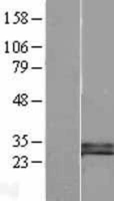 Western Blot: Dkk-1 Overexpression Lysate [NBL1-09901]