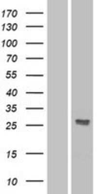 Western Blot: Dkk-2 Overexpression Lysate [NBP2-04343]