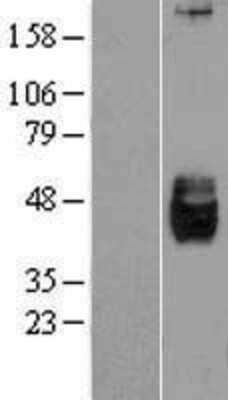 Western Blot: Dkk-3 Overexpression Lysate [NBL1-09903]