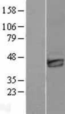 Western Blot: Dkk-3 Overexpression Lysate [NBL1-09904]