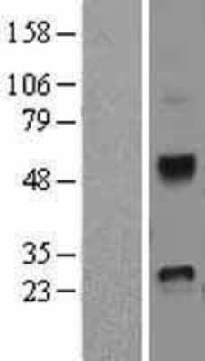 Western Blot: Dkk-4 Overexpression Lysate [NBL1-09905]