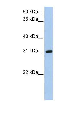 Western Blot: Soggy-1/DkkL1 Antibody [NBP1-62696]