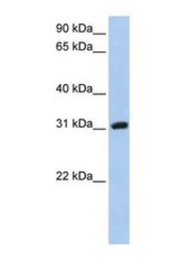 Western Blot: Soggy-1/DkkL1 Antibody [NBP1-69688]