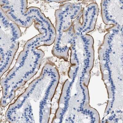 Immunohistochemistry-Paraffin: DLC1 Antibody [NBP1-88824]