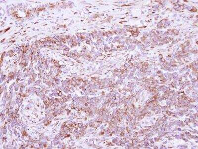 Immunohistochemistry-Paraffin: DLC1 Antibody [NBP2-16173]