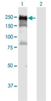 Western Blot: DLC1 Antibody [H00010395-B01P]