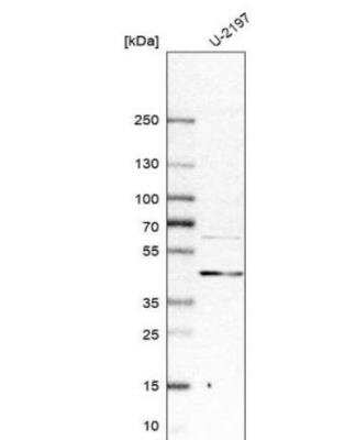 Western Blot: DLC1 Antibody [NBP1-88824]