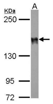 Western Blot: DLC1 Antibody [NBP2-16173]