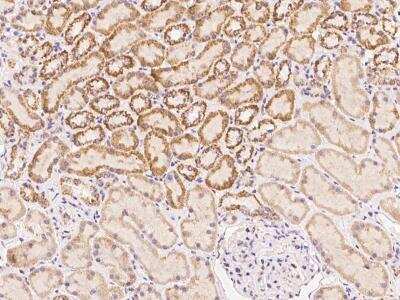 Immunohistochemistry-Paraffin: DLC1/DLEC1 Antibody [NBP3-06065]