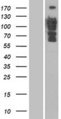 Western Blot: DLC1 Overexpression Lysate [NBP2-10056]