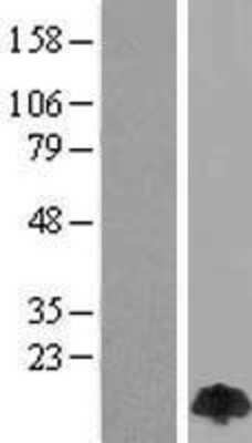 Western Blot: PIN/DLC8 Overexpression Lysate [NBP2-10547]