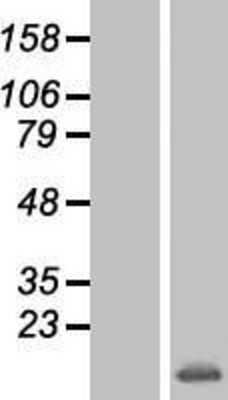 Western Blot: PIN/DLC8 Overexpression Lysate [NBP2-10621]