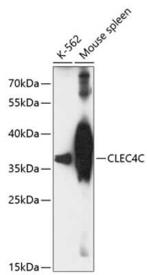 Western Blot: DLEC/CLEC4C/BDCA-2 AntibodyAzide and BSA Free [NBP2-92121]