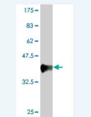 Western Blot: DLG1 Antibody (1B12) [H00001739-M03]