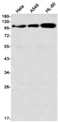 Western Blot: DLG1 Antibody (S06-6C8) [NBP3-20002]