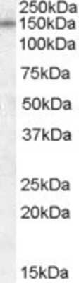 Western Blot: DLG1 Antibody [NBP1-20907]