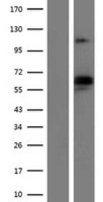 Western Blot: DLG1 Overexpression Lysate [NBP2-07915]